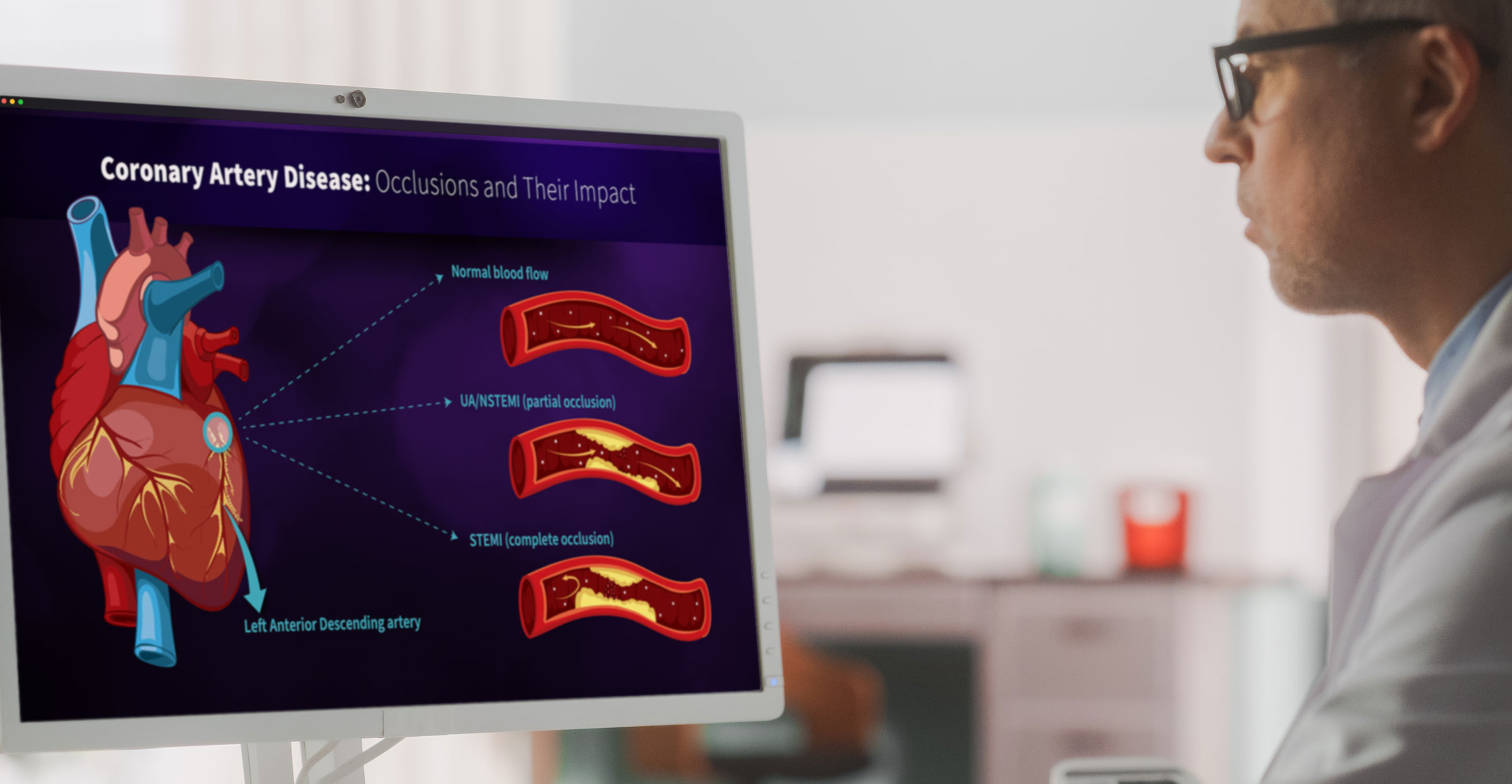 Introduction-to-the-Power-of-Explainer-Videos